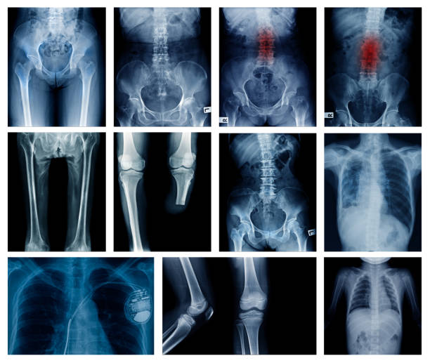 doctor for pediatric spine